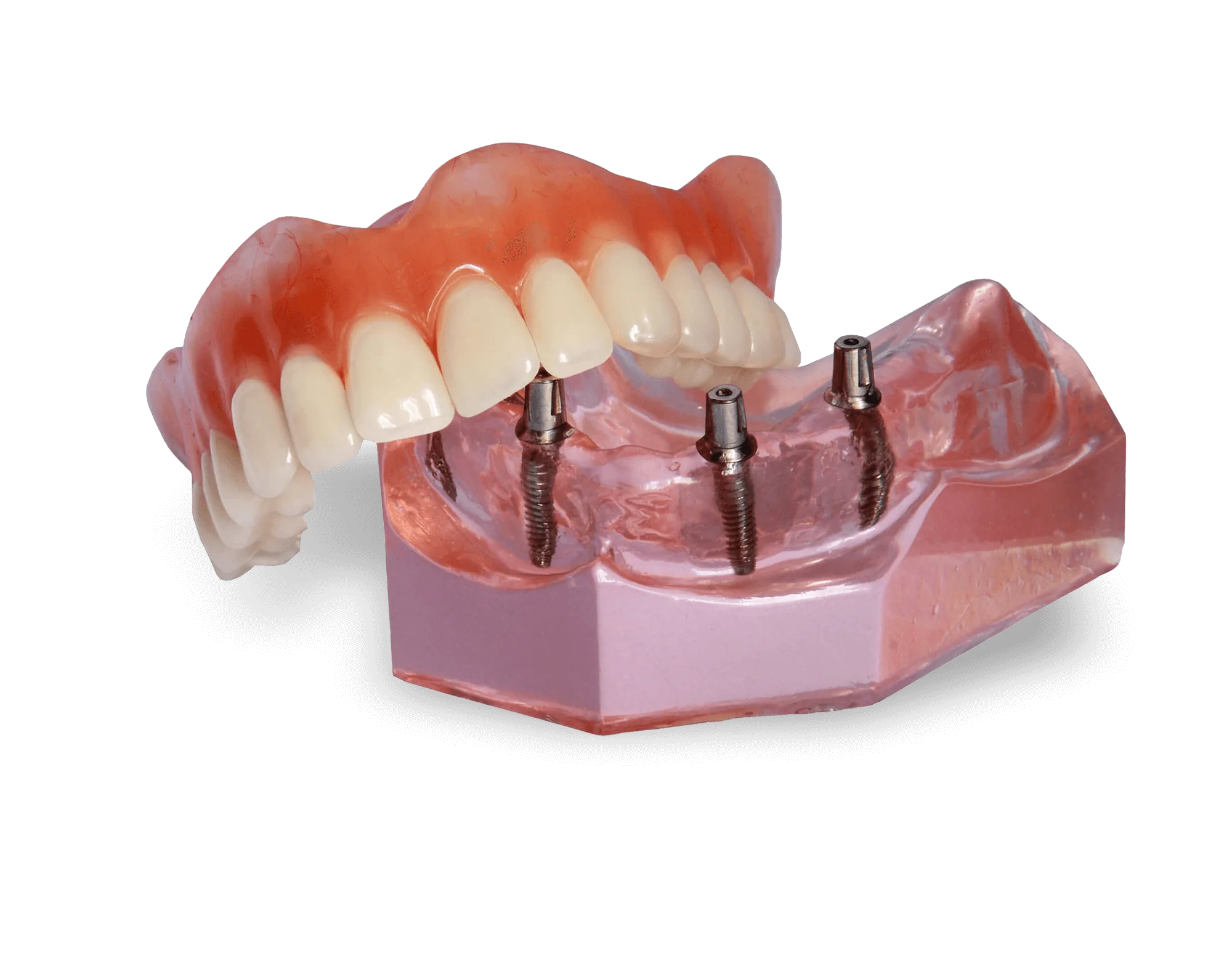 photo of dentures